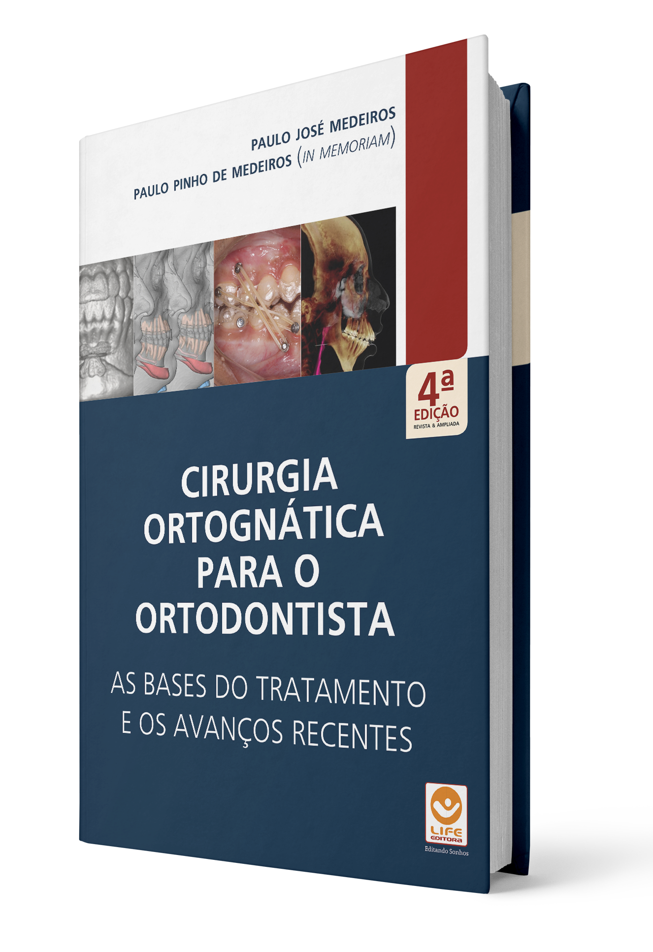 Capa de Livro Cirurgia Ortognática para o Ortodontista – As Bases do Tratamento e os Avanços Recentes